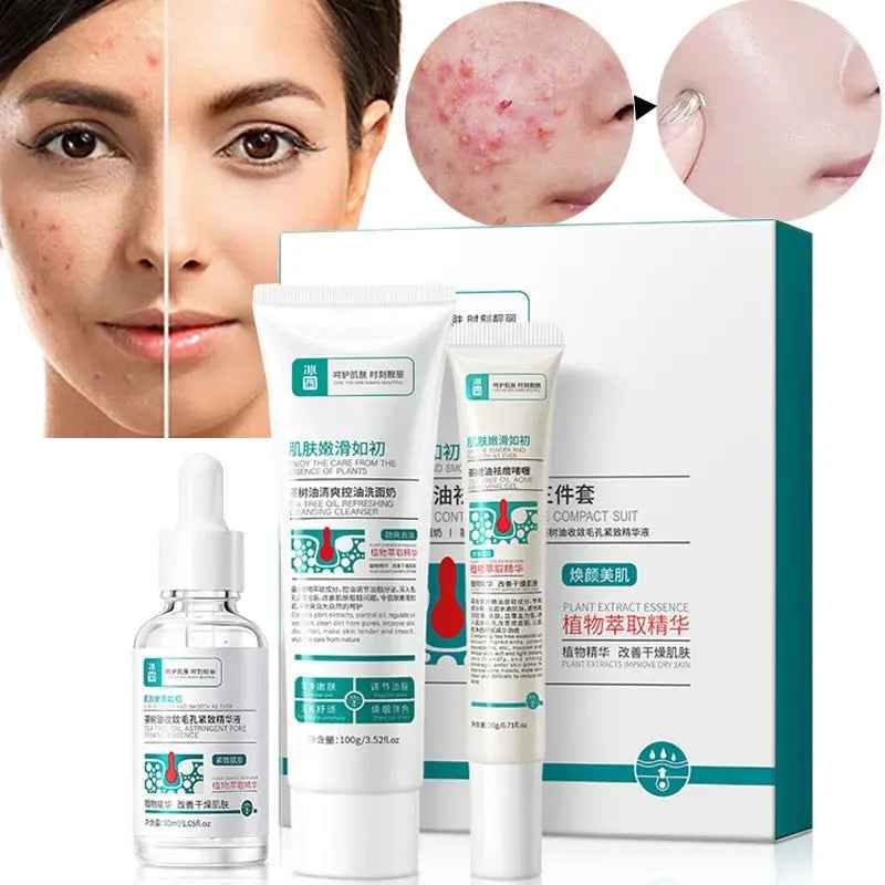 Fernglow Aloe Vera Skincare for Blemish-Prone Treatment - Fernglow