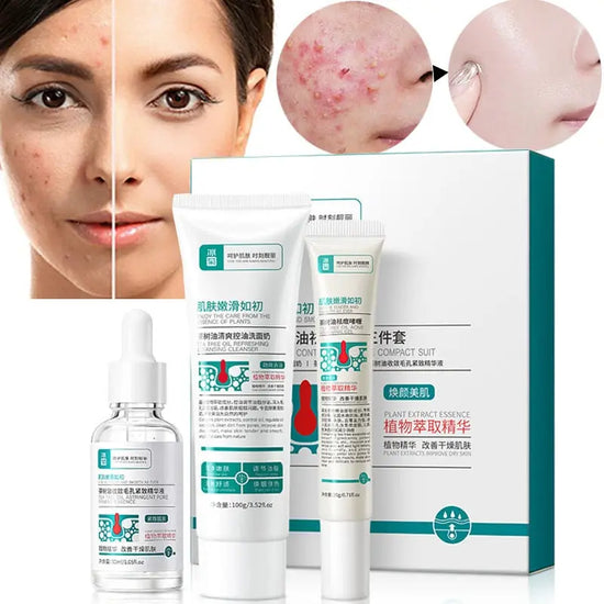 Fernglow Clarifying Cream Fernglow