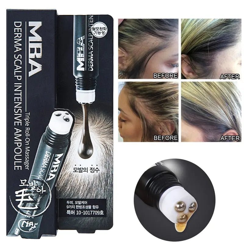 Premium Roll-On Hair Growth Serum by Fernglow - Fernglow