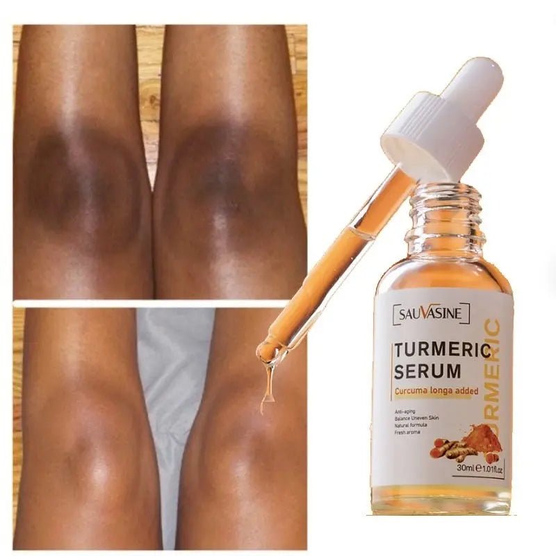 Fernglow Turmeric Glow Serum - Fernglow