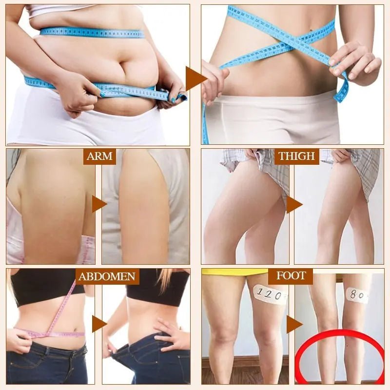 Cellulite Reduction Cream for Slimming and Firming Skin - Fernglow
