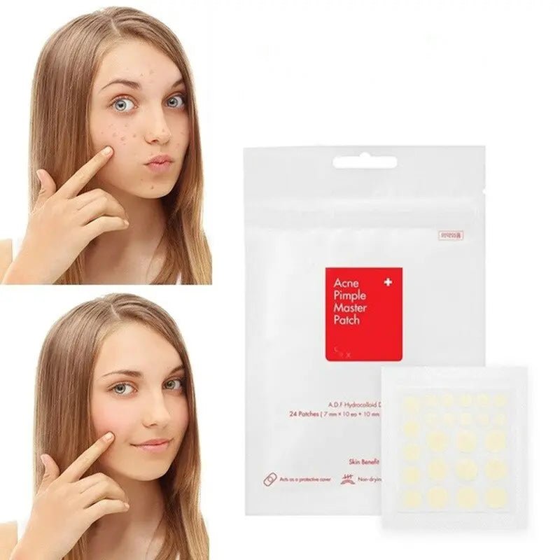 Fernglow Skin Healing Scar Treatment Stickers - Fernglow
